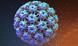 Virus HPV là gì? Con đường lây nhiễm HPV và những biểu hiện