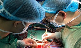 Phẫu thuật bắc cầu chủ vành – phương pháp điều trị tối ưu cho bệnh nhân mắc bệnh lý mạch vành nặng