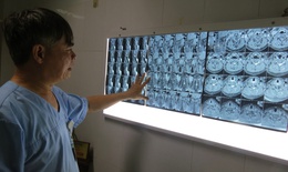 Bệnh nhân thoát tàn phế nhờ mổ u tủy sống
