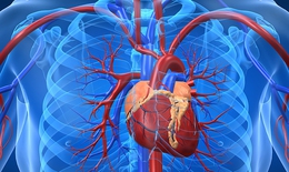 Câu hỏi thường gặp liên quan đến nhồi máu cơ tim cấp
