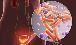 Th&#234;m loại kh&#225;ng sinh mới điều trị nhiễm tr&#249;ng đường tiết niệu