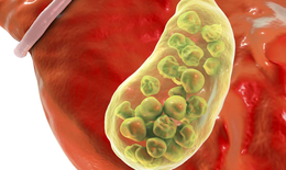 Câu hỏi thường gặp liên quan đến sỏi mật