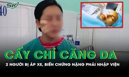 Cấy chỉ căng da, 2 người bị áp xe, biến chứng nặng