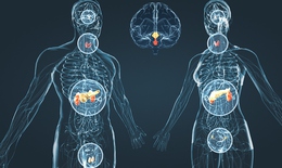 Câu hỏi thường gặp liên quan đến rối loạn nội tiết tố