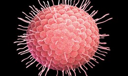 8 câu hỏi thường gặp liên quan đến bệnh thủy đậu