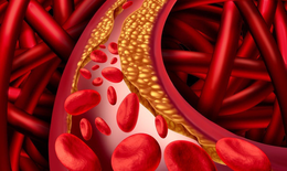 Rối loạn lipid m&#225;u c&#243; chữa khỏi được kh&#244;ng?