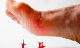 Người sau mắc bệnh uốn ván nên tập thể dục thế nào?