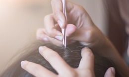 Có nên nhổ tóc bạc?