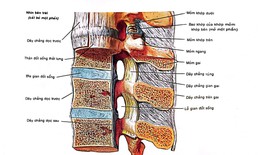 C&#225;c phương ph&#225;p trị tho&#225;t vị đĩa đệm