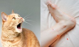 Cảnh b&#225;o trẻ bị động vật cắn, h&#250;c