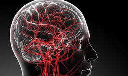 Câu hỏi thường gặp liên quan đến thiểu năng tuần hoàn não