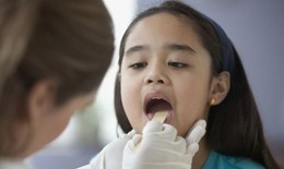 9 câu hỏi thường gặp liên quan đến bệnh viêm amidan