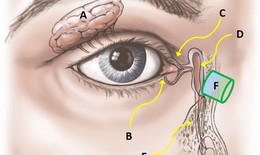 Tắc lệ đạo n&#234;n ăn g&#236; để mắt s&#225;ng khỏe?