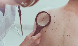 Các phương pháp điều trị ung thư da