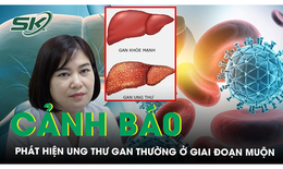 Chuyên gia cảnh báo, ung thư gan thường phát hiện ở giai đoạn muộn
