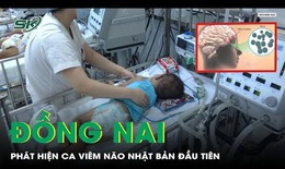 Đồng Nai: Phát hiện ca viêm não Nhật Bản đầu tiên