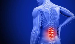 C&#225;ch giảm đau thắt lưng tại nh&#224; hiệu quả