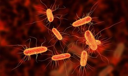 Biểu hiện nhiễm khuẩn E.coli, c&#225;ch ph&#242;ng tr&#225;nh nhiễm E.coli trong m&#249;a h&#232;