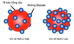 HbA1c l&#224; g&#236;? V&#236; sao người tiểu đường cần quan t&#226;m đến x&#233;t nghiệm HbA1c?