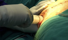 Bộ Y tế y&#234;u cầu xử l&#253; nghi&#234;m cơ sở thẩm mỹ mạo danh bệnh viện, hoạt động &#39;chui&#39;