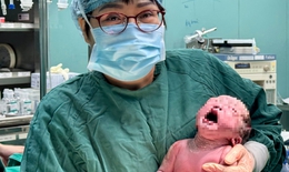 Sản phụ 1m30 bị biến dạng xương sinh thành công bé gái kháu khỉnh