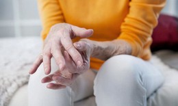 Bài tập tốt cho người bệnh xơ cứng bì toàn thể