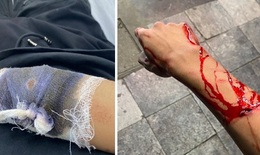 Đi xem bóng đá về lúc rạng sáng bất ngờ bị chém