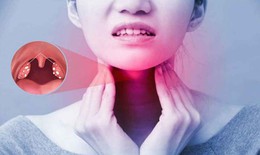 Dấu hiệu của viêm amidan hốc mủ