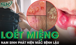 Lầm tưởng tai hại về quan hệ bằng miệng, nam sinh hối kh&#244;ng kịp