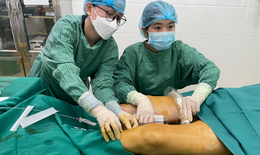 Suy tĩnh mạch nông chi dưới: Nguyên nhân, triệu chứng và cách điều trị