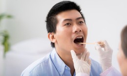 9 câu hỏi thường gặp liên quan đến bệnh bạch sản