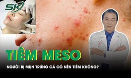 Người đang bị mụn trứng c&#225; c&#243; n&#234;n ti&#234;m meso kh&#244;ng?