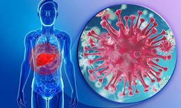 Người nhiễm HIV đồng nhiễm vi&#234;m gan B, C chữa ở đ&#226;u?