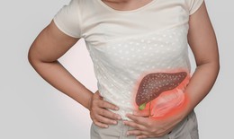 Nguy&#234;n nh&#226;n g&#226;y vi&#234;m tụy mạn