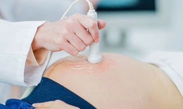 Câu hỏi thường gặp liên quan đến bệnh thiểu ối