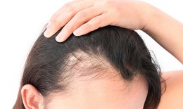 Cách giảm rụng tóc và giúp tóc mọc nhanh tại nhà