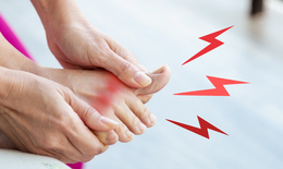 Thời tiết nắng nóng cẩn thận với cơn gout cấp
