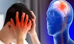 Nghệ nhân đang biểu diễn trên sân khấu bất ngờ ngã gục, bác sĩ cảnh báo những yếu tố làm tăng nguy cơ đột quỵ