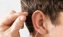 Câu hỏi thường gặp liên quan đến mất thính lực