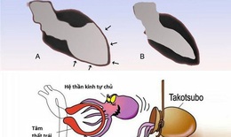 Điều g&#236; xảy ra với tr&#225;i tim khi bạn thất t&#236;nh?