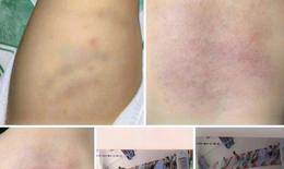 Công an xác minh hình ảnh cháu bé 1 tuổi ở Bình Thuận nghi bị bạo hành
