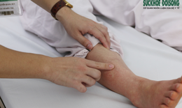 Mùa mưa lũ cẩn thận với sốt xuất huyết