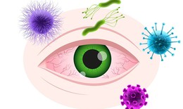 Loét giác mạc: Nguyên nhân, triệu chứng, cách điều trị và phòng bệnh