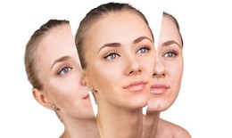 3 dấu hiệu nhận biết da bị lão hóa