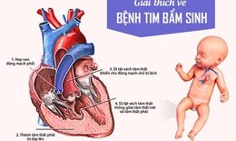 Tim bẩm sinh: Nguy&#234;n nh&#226;n, triệu chứng, phương ph&#225;p điều trị