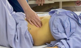 Uống 100 viên thuốc 'lạ' mỗi ngày, da cụ bà chuyển màu vàng như nghệ rồi nhập viện gấp