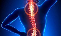Người trẻ c&#243; mắc tho&#225;i h&#243;a cột sống kh&#244;ng?