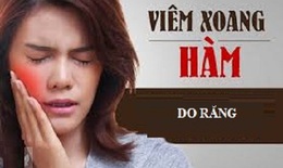 Khi nào cần nghĩ đến viêm xoang hàm do răng?