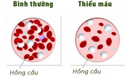 Tay chân lạnh cảnh báo điều gì?