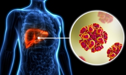 Sống khỏe với HIV v&#224; vi&#234;m gan C - tương lai đầy hy vọng cho người đồng nhiễm